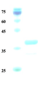 Leishmania K28 protein (detection) Leishmania K28 protein (detection)
