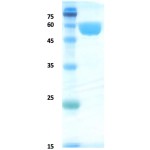 Pathogenic Leptospira lipoprotein LipL32