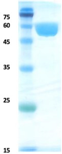Pathogenic Leptospira lipoprotein LipL32