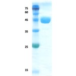 Lymphatic Filariasis SXP-1 protein