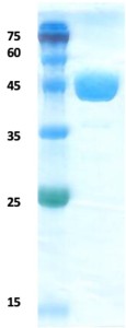 Lymphatic Filariasis SXP-1 protein