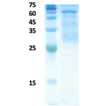 Plasmodium falciparum histidine-rich protein 2 (Pf-HRP II)