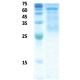 Plasmodium falciparum histidine-rich protein 2 (Pf-HRP II)