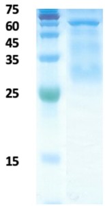 Plasmodium falciparum histidine-rich protein 2 (Pf-HRP II)