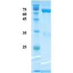 Plasmodium falciparum Aldolase protein