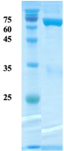 Plasmodium falciparum Aldolase protein