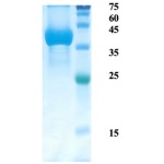 Plasmodium falciparum merozoite surface protein 1 (capture)