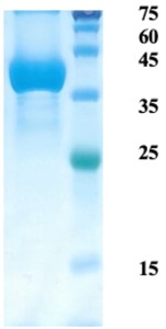 Plasmodium falciparum merozoite surface protein 1 (capture)