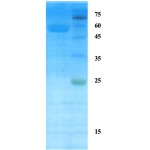 Plasmodium vivax lactate dehydrogenase (Pv-LDH) protein