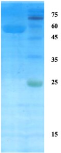 Plasmodium vivax lactate dehydrogenase (Pv-LDH) protein