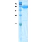 Plasmodium falciparum lactate dehydrogenase (Pf-LDH) protein