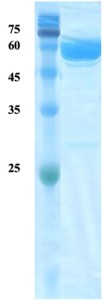 Plasmodium falciparum lactate dehydrogenase (Pf-LDH) protein