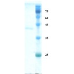 Plasmodium vivax merozoite surface protein 1 (detection)