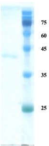 Plasmodium vivax merozoite surface protein 1 (detection)