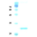 Plasmodium vivax merozoite surface protein 1 (capture)