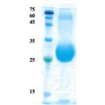 Plasmodium falciparum merozoite surface protein 1 (detection)