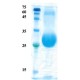 Plasmodium falciparum merozoite surface protein 1 (detection)