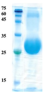 Plasmodium falciparum merozoite surface protein 1 (detection) Plasmodium falciparum merozoite surface protein 1 (detection)