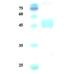 Plasmodium malariae lactate dehydrogenase (Pm-LDH) protein