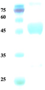 Plasmodium malariae lactate dehydrogenase (Pm-LDH) protein