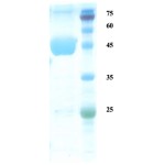 Plasmodium ovale lactate dehydrogenase (Po-LDH) protein