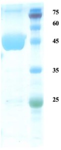 Plasmodium ovale lactate dehydrogenase (Po-LDH) protein