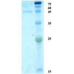 Treponema pallidum (Syphilis) p15 protein