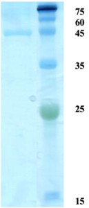 Treponema pallidum (Syphilis) p15 protein