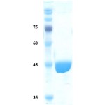 Treponema pallidum (Syphilis) p17 protein (capture)  