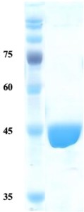 Treponema pallidum (Syphilis) p17 protein (capture)  