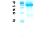 Treponema pallidum (Syphilis) p47 protein (capture)  