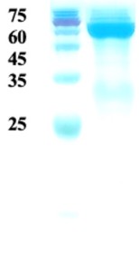 Treponema pallidum (Syphilis) p47 protein (capture)  