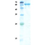 Treponema pallidum (Syphilis) p17/p47 fusion protein (capture/detection)  