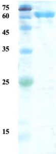 Treponema pallidum (Syphilis) p17/p47 fusion protein (capture/detection)  
