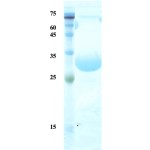 Treponema pallidum (Syphilis) p17 protein (detection)  