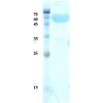 Treponema pallidum (Syphilis) p47 protein (detection)  