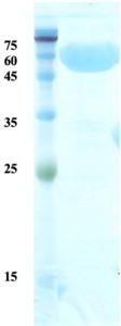 Treponema pallidum (Syphilis) p47 protein (detection)  