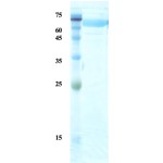 Treponema pallidum (Syphilis) p17/p47 fusion protein (capture)  