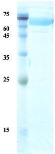 Treponema pallidum (Syphilis) p17/p47 fusion protein (capture)  