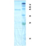 Mycobacterium tuberculosis antigen 14/16 chimeric protein