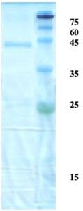 Mycobacterium tuberculosis antigen 14/16 chimeric protein