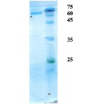 Mycobacterium tuberculosis antigen 6/14/38 chimeric protein