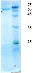 Mycobacterium tuberculosis antigen 6/14/38 chimeric protein