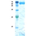 Mycobacterium tuberculosis antigen 38 protein