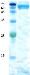 Mycobacterium tuberculosis antigen 38 protein Mycobacterium tuberculosis antigen 38 protein