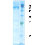 Mycobacterium tuberculosis antigen 14/16 chimeric protein