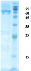 Mycobacterium tuberculosis antigen 14/16 chimeric protein Mycobacterium tuberculosis antigen 14/16 chimeric protein