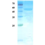 Mycobacterium tuberculosis major secretory  protein antigen 85B