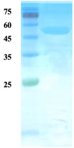 Mycobacterium tuberculosis major secretory  protein antigen 85B
