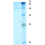 Toxoplasma gondii surface antigen (SAG) 2 (capture)  